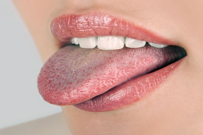 जीभ की ये 5 स्थितियां बताती हैं कि आपका स्वास्थ्य है खराब!